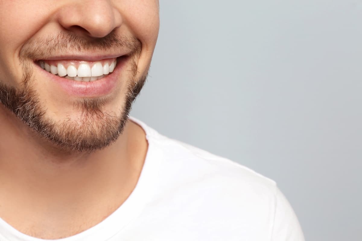 Do Composite Veneers Require Removal Of Natural Tooth?